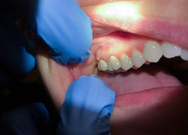 Best Mobile Emergency Dentist in New Glarus, WI